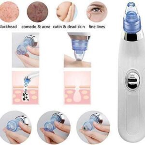 Blackhead Remover Extractor Multifunction 4 in 1