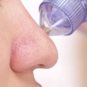 Blackhead Remover Extractor Multifunction 4 in 1